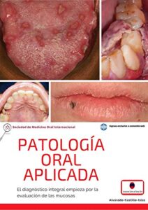 Patologia Bucal